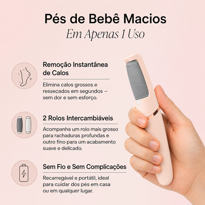 Velura™ Removedor Elétrico de Calos 2.0 – Tecnologia Profissional Para Pés de Bebê